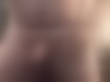 almost_nkd
